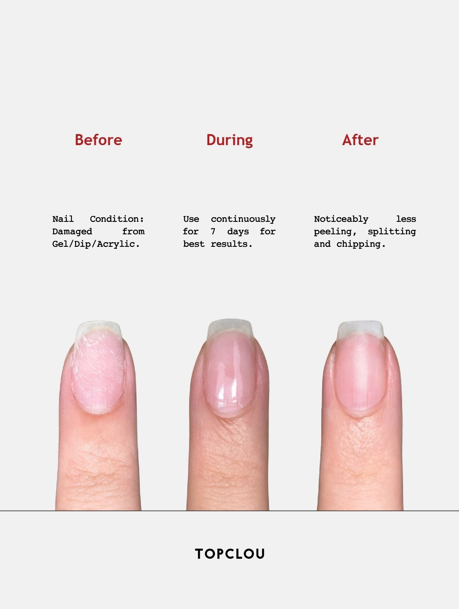 Topclou Nailhaus TOPCLOU Keratin Nail Treatment